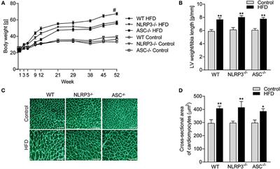 NLRP3 Inflammasome Promotes Myocardial Remodeling During Diet-Induced Obesity